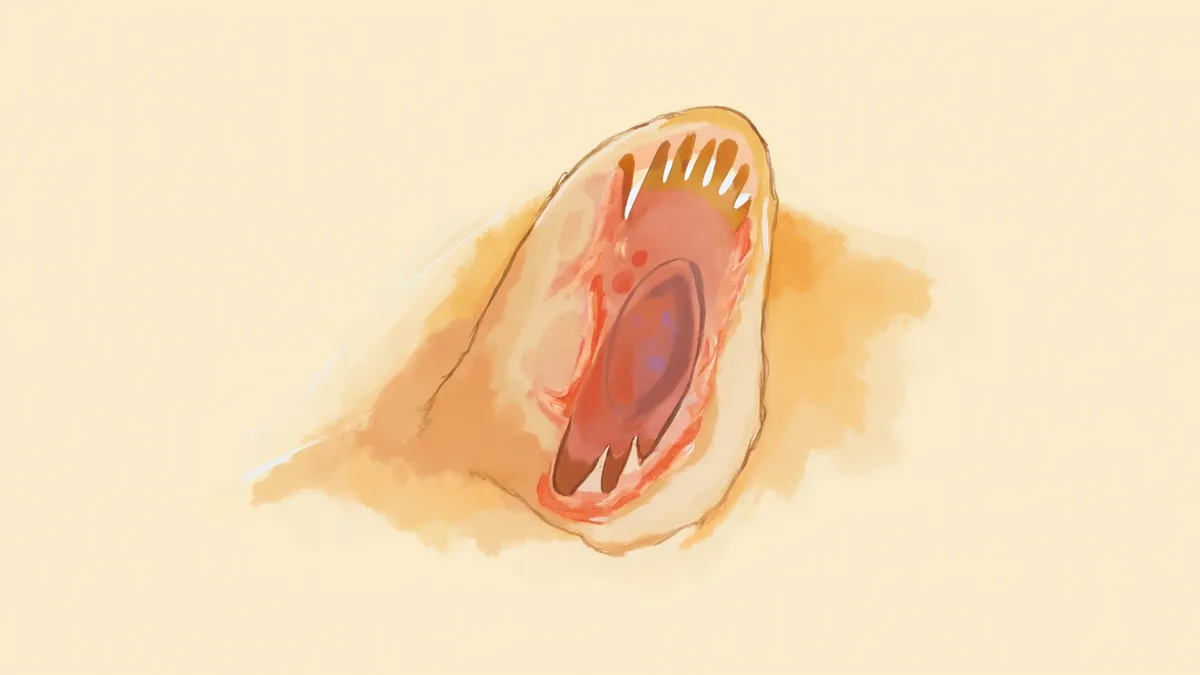 강아지 외이도 내부에 생긴 폴립 단면 일러스트