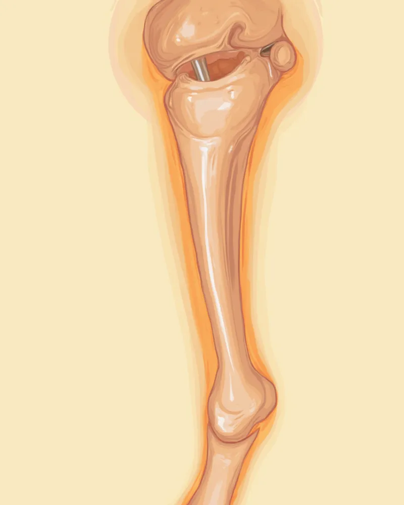 경골조면 전위술 과정을 보여주는 수의외과 일러스트